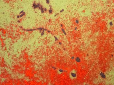 Lime fields meet the rust, orange spots claim the heavy, light marks the finish