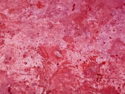 Red mist holds the field, mottled patterns trace the skin, years leave a deep trace