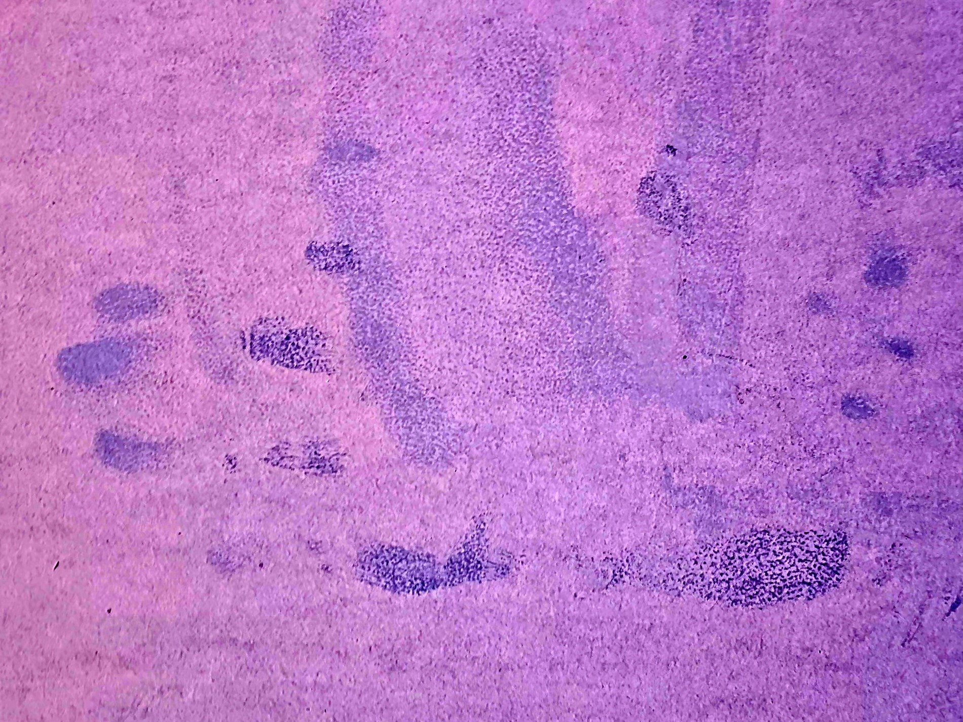 Purple ink remains, ghostly prints on fiber deep, time records the touch